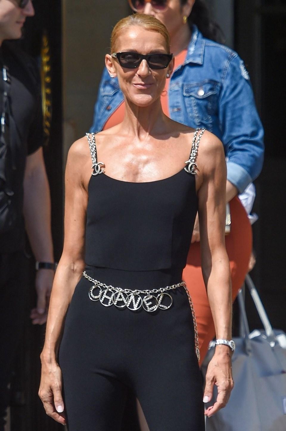 Bir dəri, bir sümük qalıb - FOTOLAR